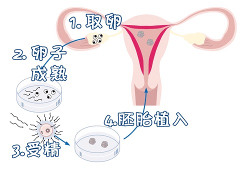 妇科专家